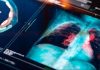 La OMS advierte: el cáncer podría duplicar su incidencia en 2050 si no se toman medidas urgentes